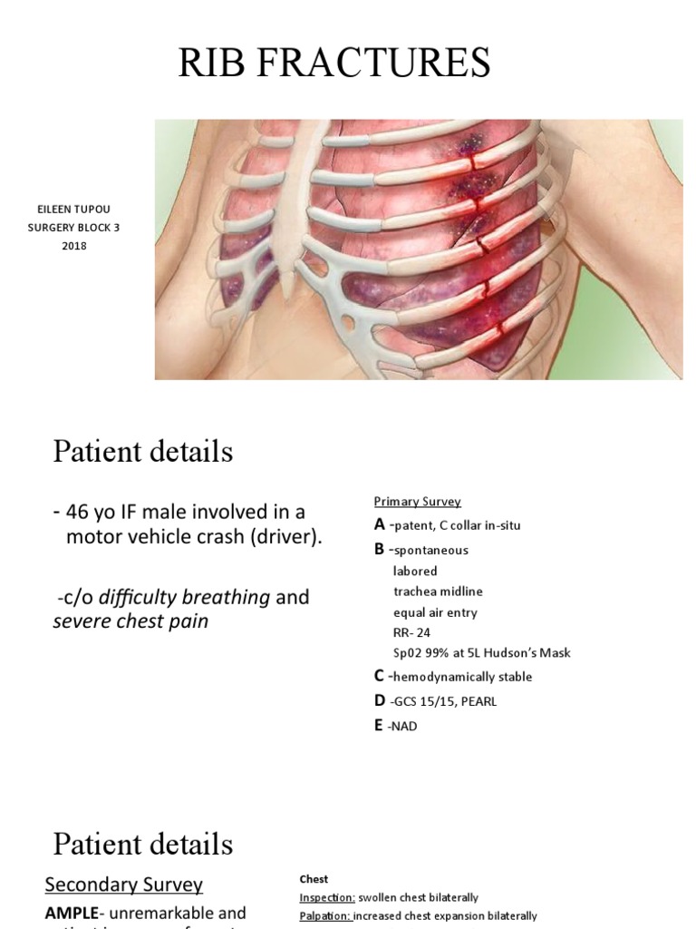 Rib Fractures | PDF | Thorax | Medical Emergencies