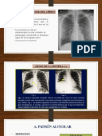 Tarea Individual Radiologia 2019