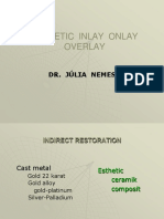 Esthetic Inlay,Onlay, Overlay.pdf