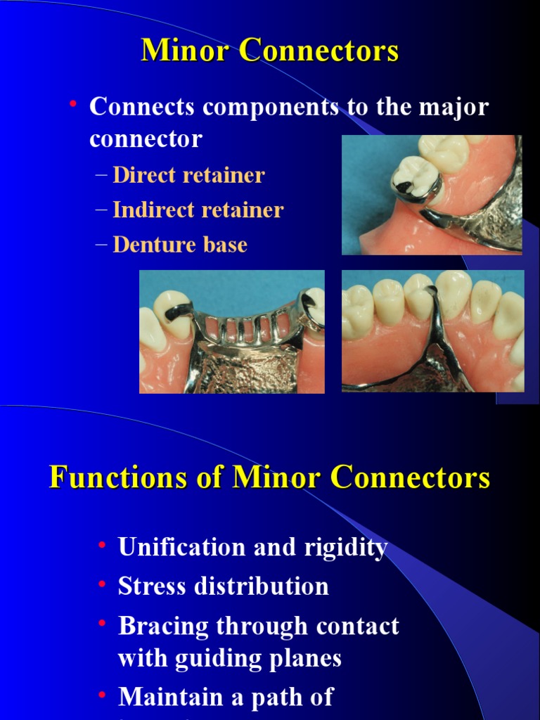 Connects Components To The Major Connector Minor Connectors PDF