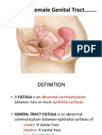 Fistula in Female Genital Tract .