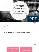 Lesiones Óseas y de Otros Tipos