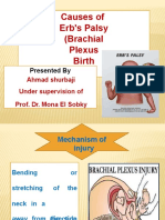 Causes of Erb's Palsy (Brachial Plexus Birth Palsy) : Presented by