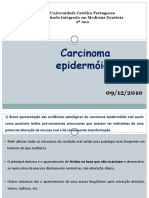 Carcinoma Epidermóide