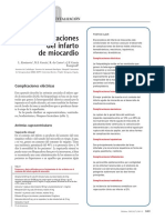 Complicaciones Del Infarto de Miocardio PDF