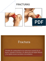 1.- FRACTURAS