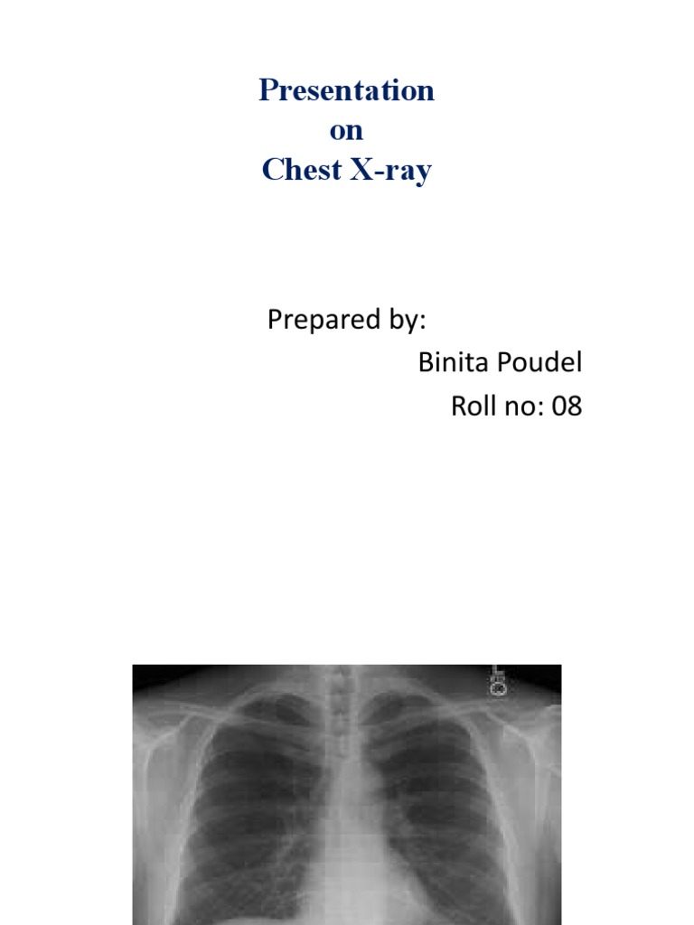 Chest X-ray Overview and Techniques | PDF | Thorax | Radiography