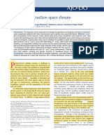 Stability of Extraction Space Closure: Original Article