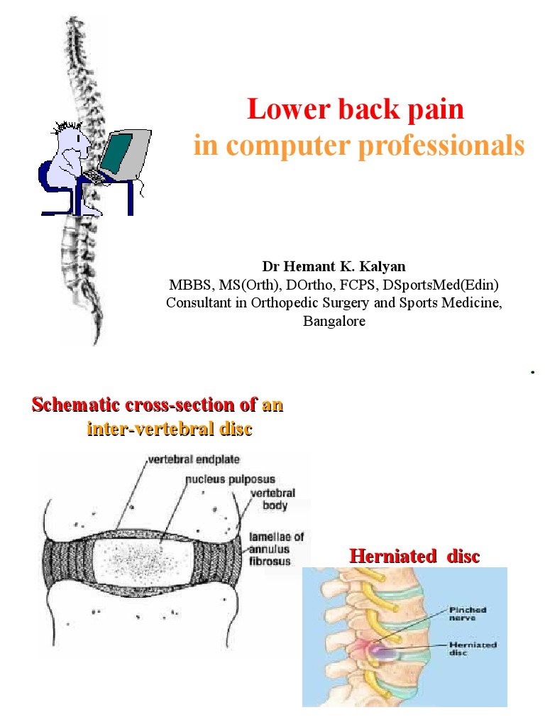 Lower Back Pain: in Computer Professionals | PDF | Back Pain | Low Back ...