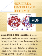 Ingrijirea Pacientului Cu Leucemie