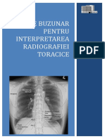 Ghid de buzunar pt interpretarea radiografiei toracice 2013.doc