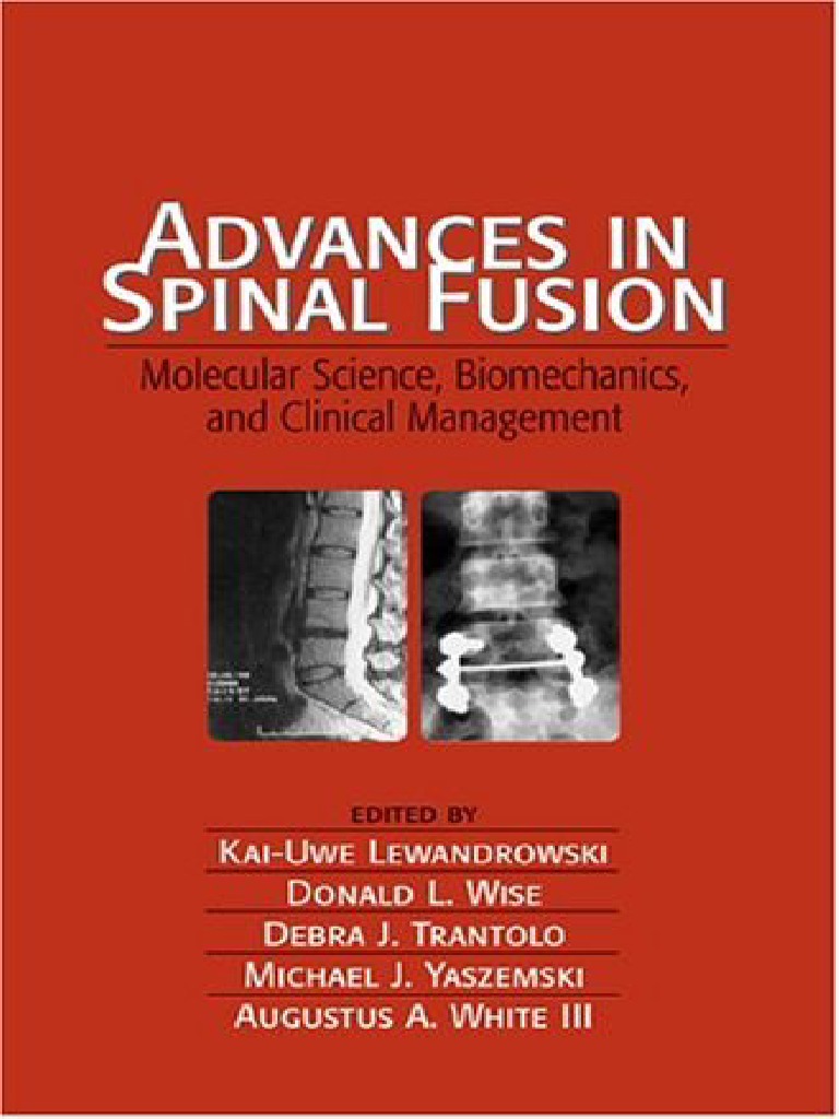 Advances In Spinal Fusion Molecular Science Biomechanics And