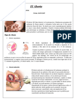 Tipos de Aborto y sus Características