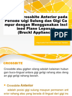 Koreksi Crossbite Anterior Pada Periode Gigi Sulung Dan Gigi Campur Dengan Menggunakan Inclined Plan