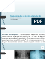 Signos Radiologicos de Apendicitis