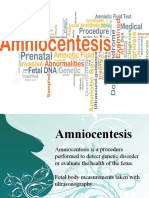 Amniocentesis