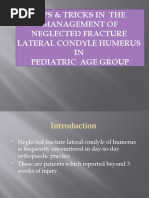 Lateral Condyle Fracture Tips and Tricks