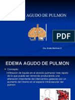 Edema Agudo de Pulmon