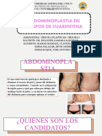 Abdominoplastia