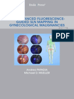 Icg-Enhanced Fluorescence-Guided SLN Mapping in Gynecological Malignancies