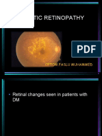 DIABETIC RETINOPATHY: SIGNS, STAGES, TREATMENT