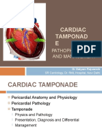 Cardiac Tamponad E: Pathophysiology and Management