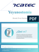 Yeyunostomía