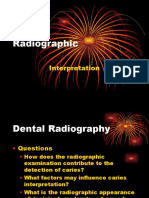 Radiographic Detection and Interpretation of Dental Caries