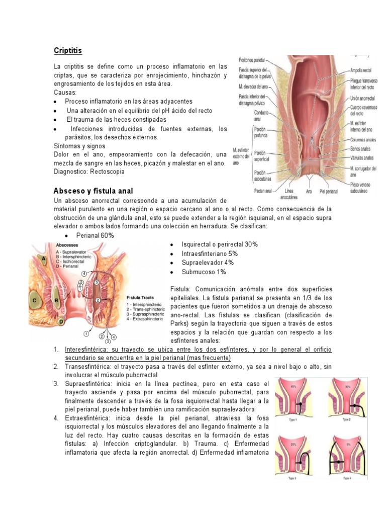 Criptitisabsceso Fistula y Fisura Anal | PDF | Enfermedades y ...