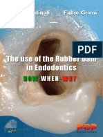 The Use of The Rubber Dam in Endodontics