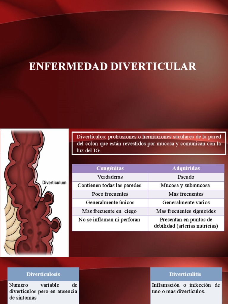 Diverticulitis | PDF | Rtt | Enfermedades y trastornos