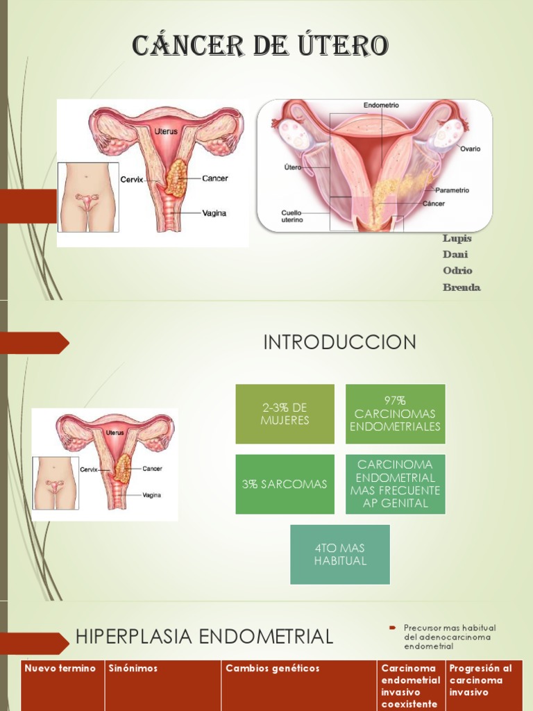 cancer endometrial mas frecuente