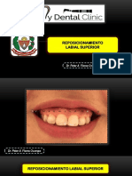 (TX) REPOSICIONAMIENTO LABIAL SUPERIOR PDF