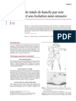 Arthroplastie totale de hanche par voie antérieure et son év.pdf