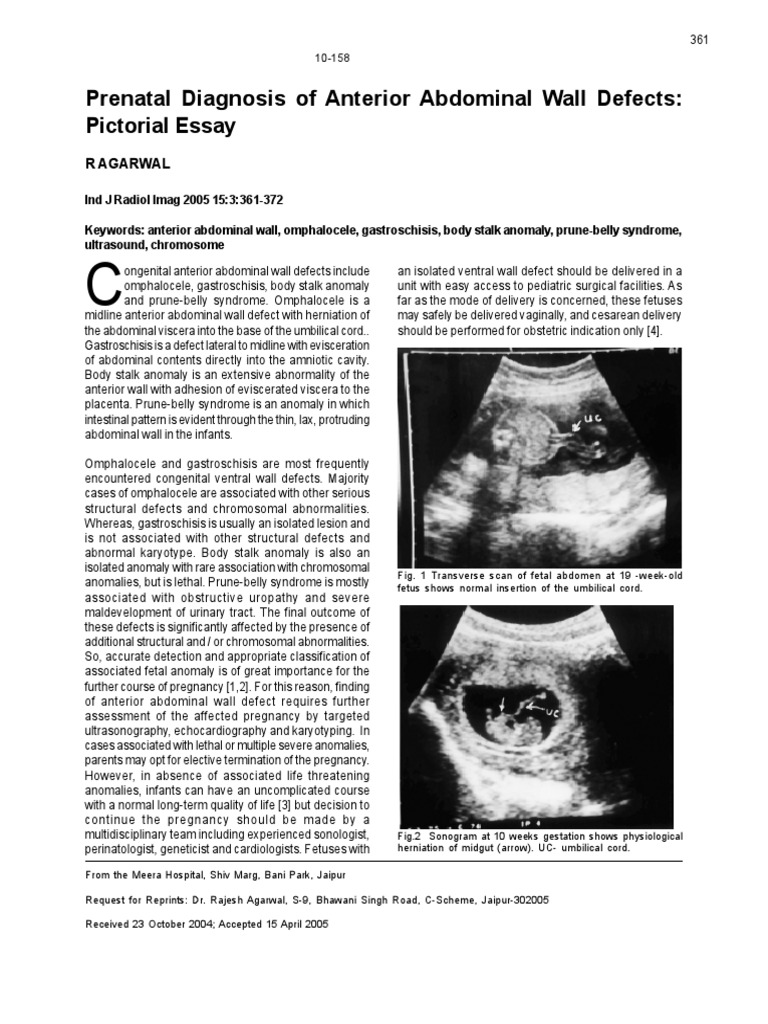 Prenatal Diagnosis of Anterior Abdominal Wall Defects: Pictorial Essay ...