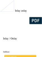 Inlayonlay