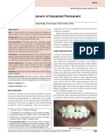 Alternative Management of Impacted Permanent Central Incisor