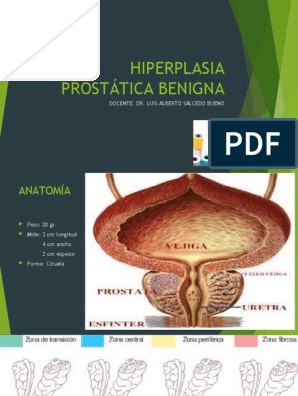 hiperplasia prostática grado 4 pdf)