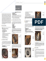 Fallas Mecanicas en Motores PDF