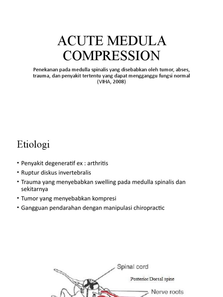 Acute Medulla Compression | PDF