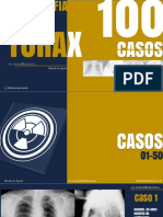 Radiografia do Tórax - 100 Casos