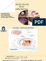 Nefro Urologia Neoplasia de Pene