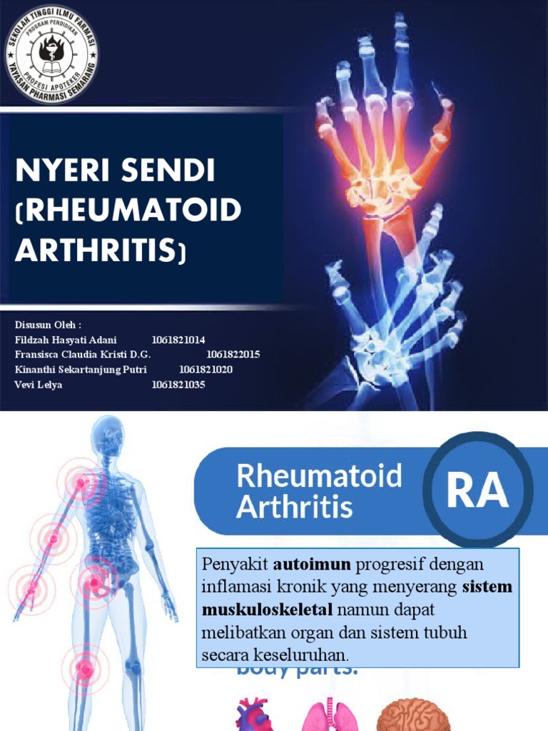 Power Point Rheumatoid Arthritis | PDF