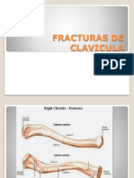 Fracturas de Clavicula PDF