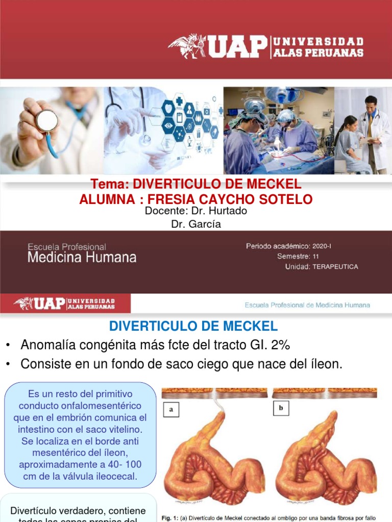 DIVERTICULITIS | PDF | Enfermedades digestivas | Rtt
