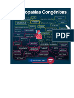 Mapa Mental de Cardiopatia Congênita