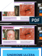 Síndromes de úlcera genital: Linfogranuloma venéreo y Donovanosis