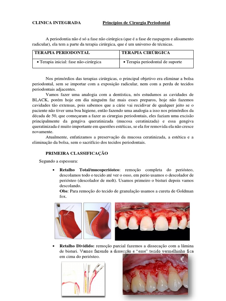 Tipos de Retalhos em Cirurgia Periodontal | PDF | Boca | Odontologia