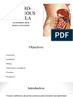 Entero Cutaneous Fistula