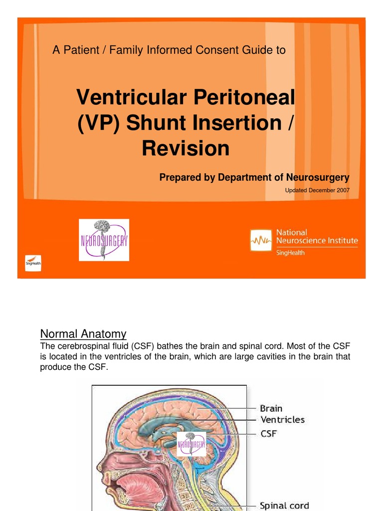 VP Shunt Insertion and Revision Guide | PDF